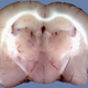 Illustration for article titled Transplanted Rat Brains Could Beat Alzheimers